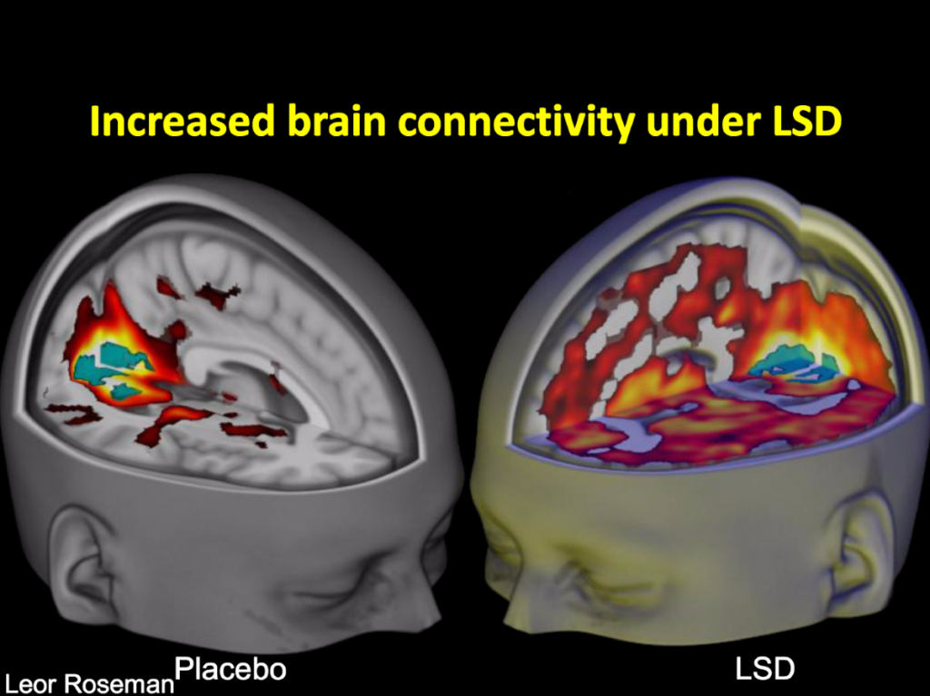 Brain connectivity under LSD compared to a placebo