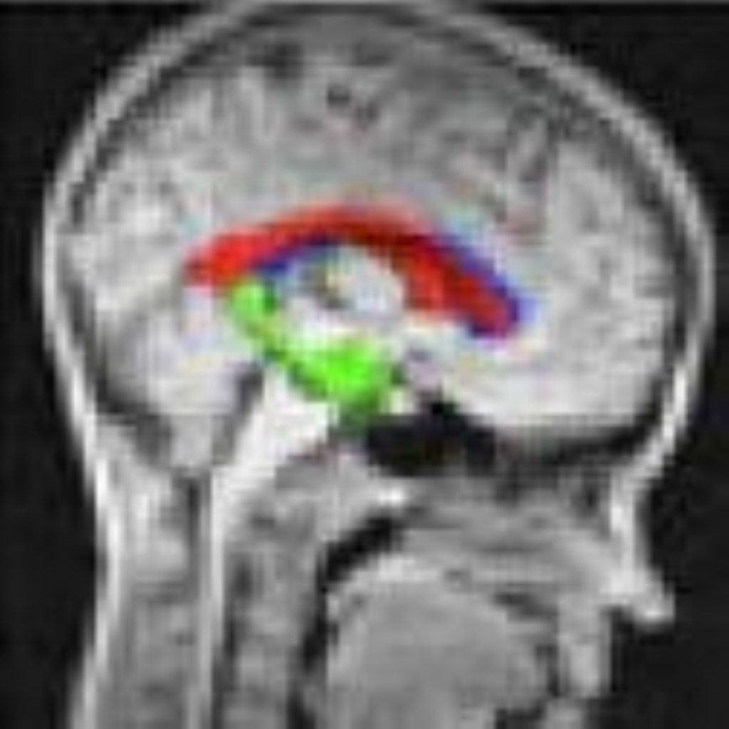 Brain imaging is an important aspect of stroke care