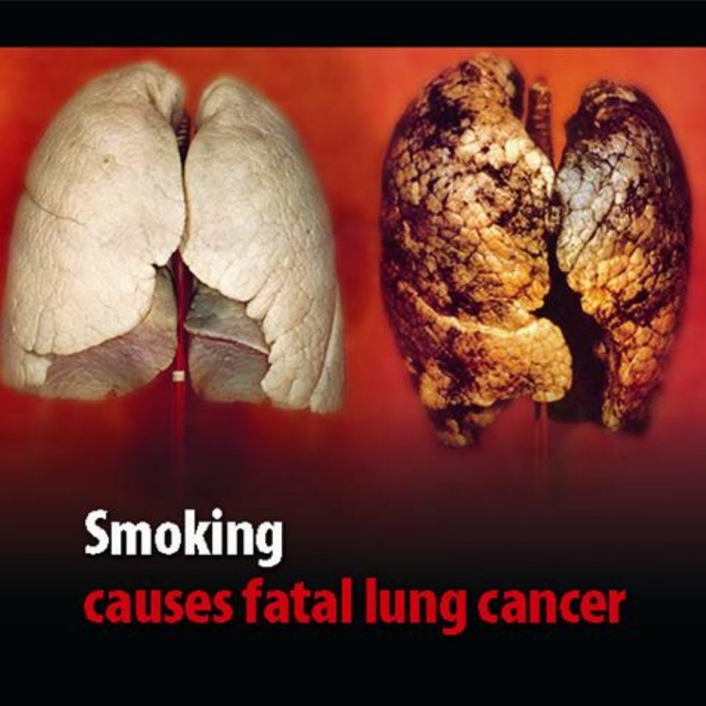 Lung cancer warning among new images
