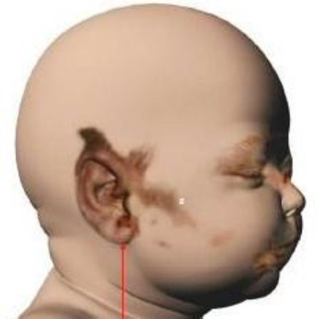 An illustration of Baby P's injuries